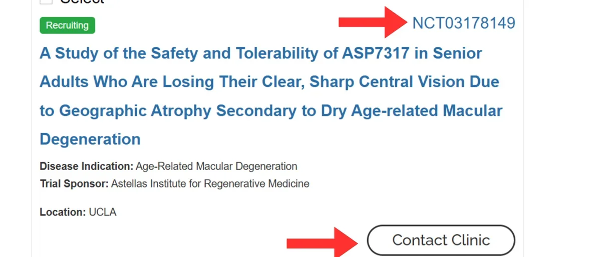 Clinical Trial profile on CIRM website with arrows pointing at the "NCT" number in top right corner and "Contact Clinic" button