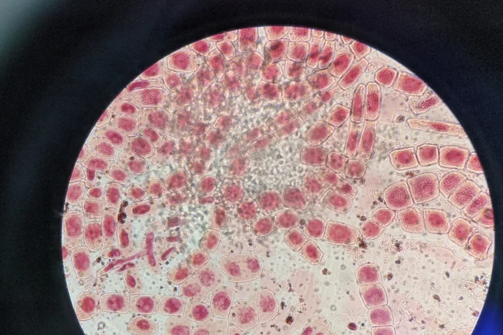  red and light pink cells under microscope