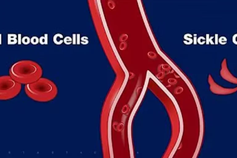 CRISPR Trial