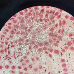  red and light pink cells under microscope