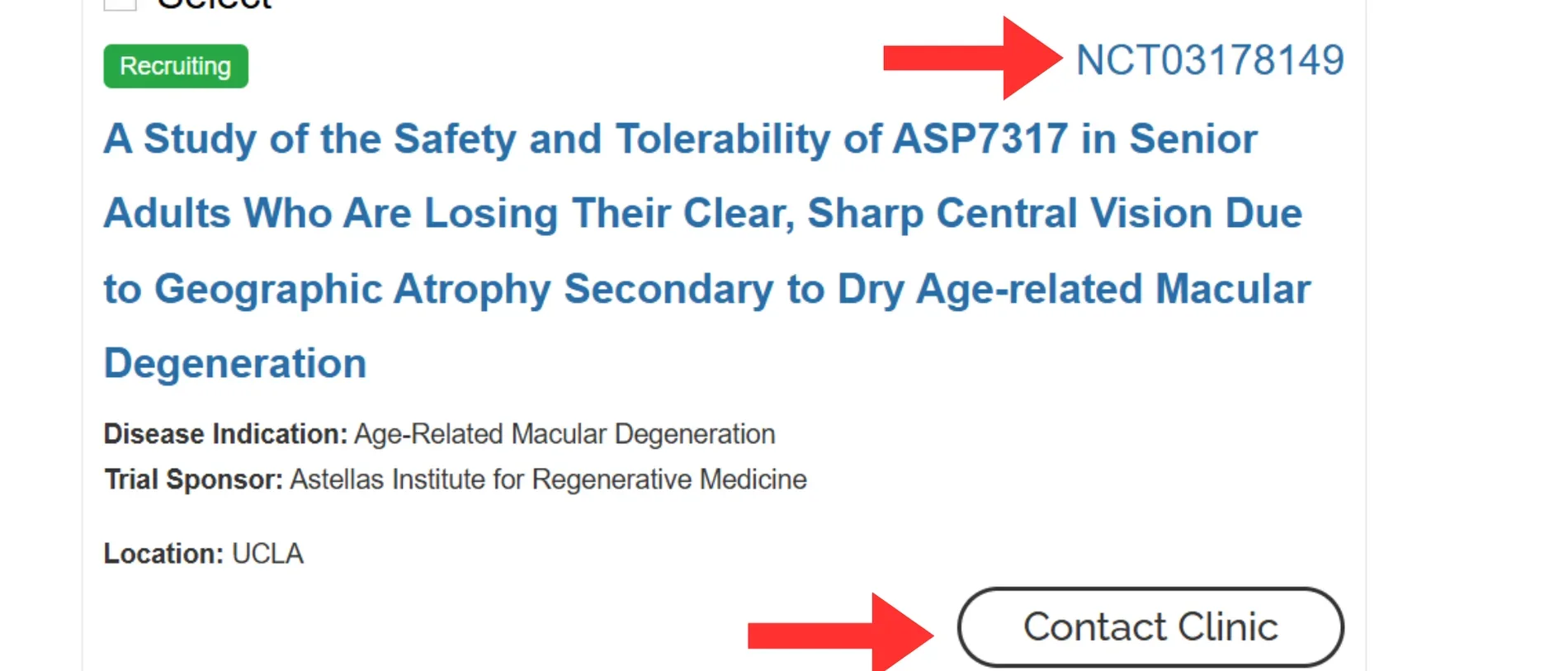 Clinical Trial profile on CIRM website with arrows pointing at the "NCT" number in top right corner and "Contact Clinic" button